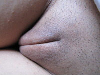 close up shaved vagina walls smile pussy shaved vulva close normal closeup