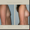 very small breasts photos